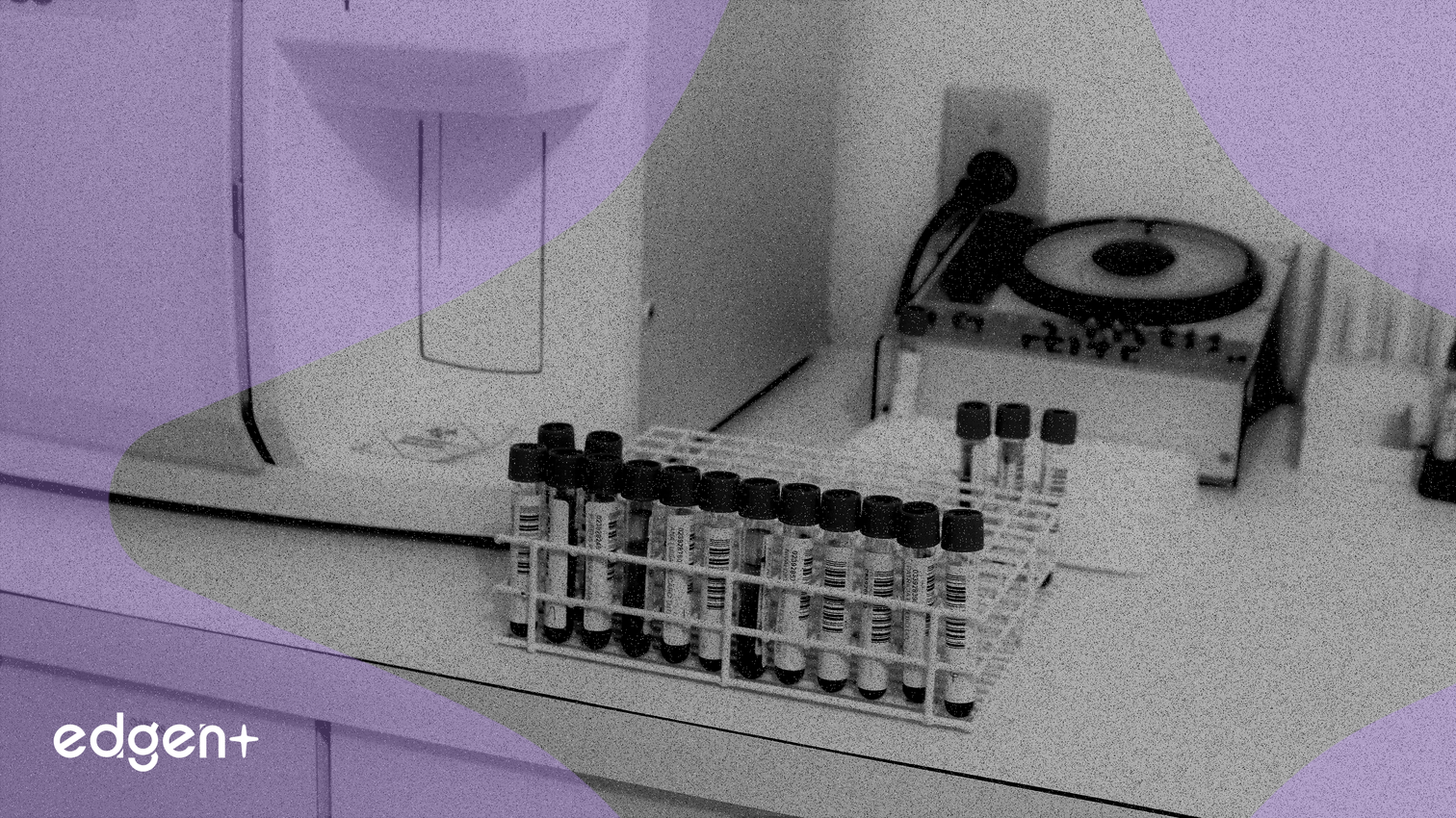 Xét nghiệm Oncoguard Liver của Exact Sciences chứng minh khả năng phát hiện ung thư sớm vượt trội trong nghiên cứu ALTUS