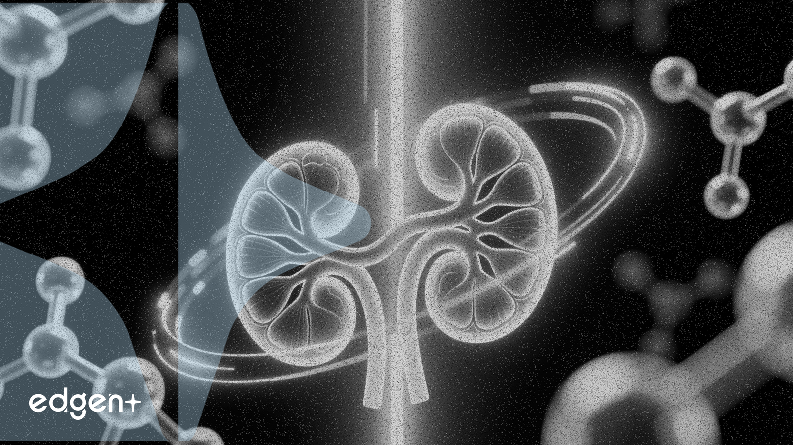 Qian Yuan Pharma obtiene aprobación para el medicamento para la enfermedad renal Evocalcet