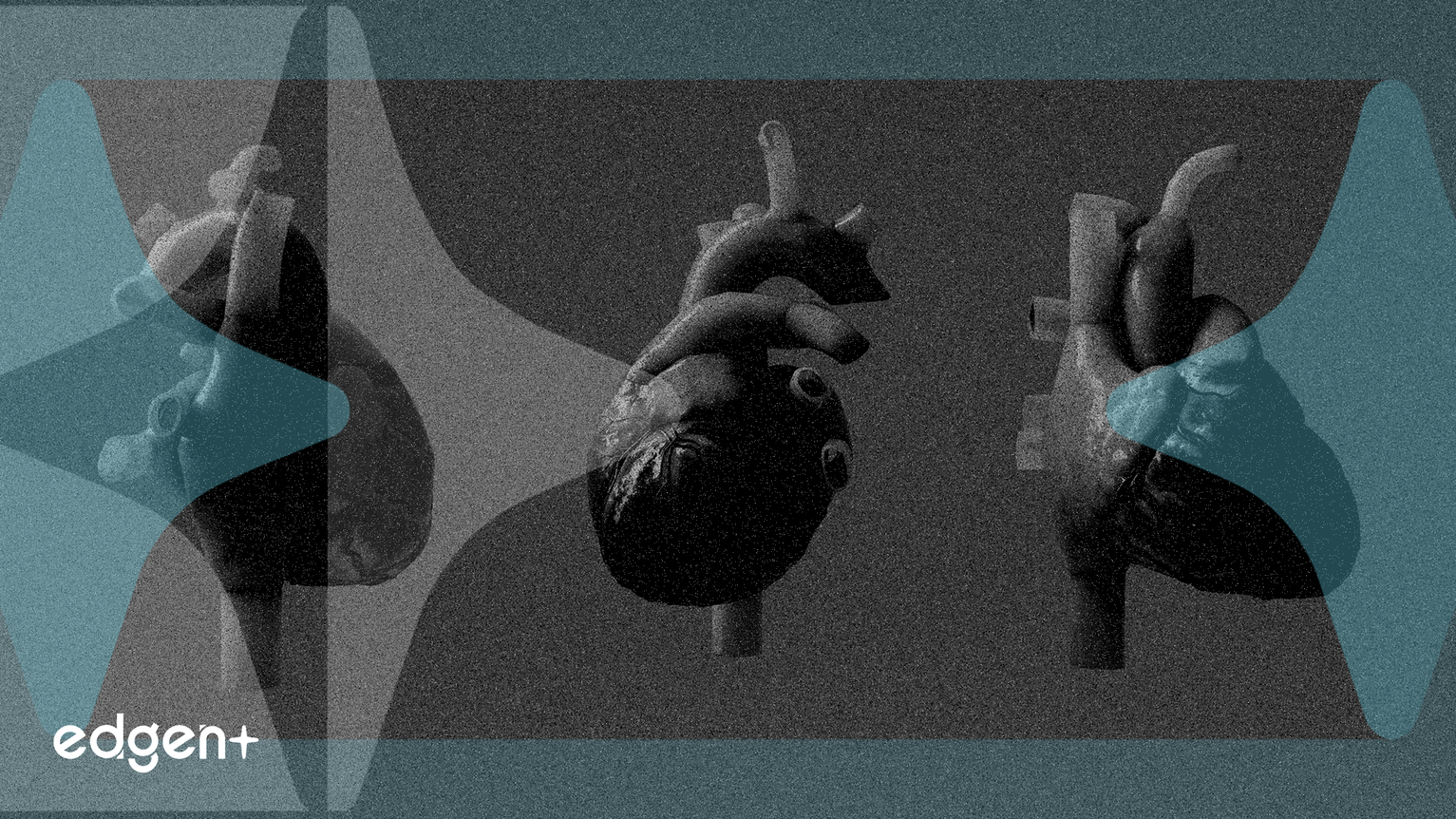 Pulse Biosciences 獲得 FDA 批准進行心臟治療研究