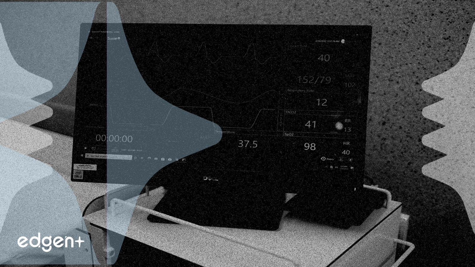 Tempus AI 通过 FDA 批准挑战心脏病学市场