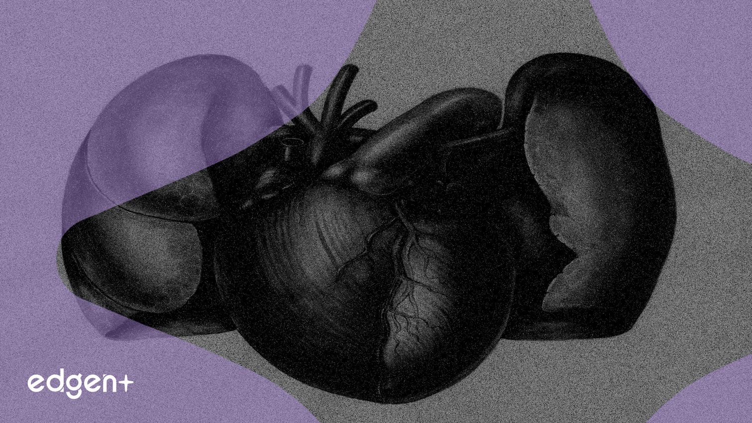 Casgevy 매출 2,400만 달러 미달에도 불구하고 Citizens, CRISPR 지지