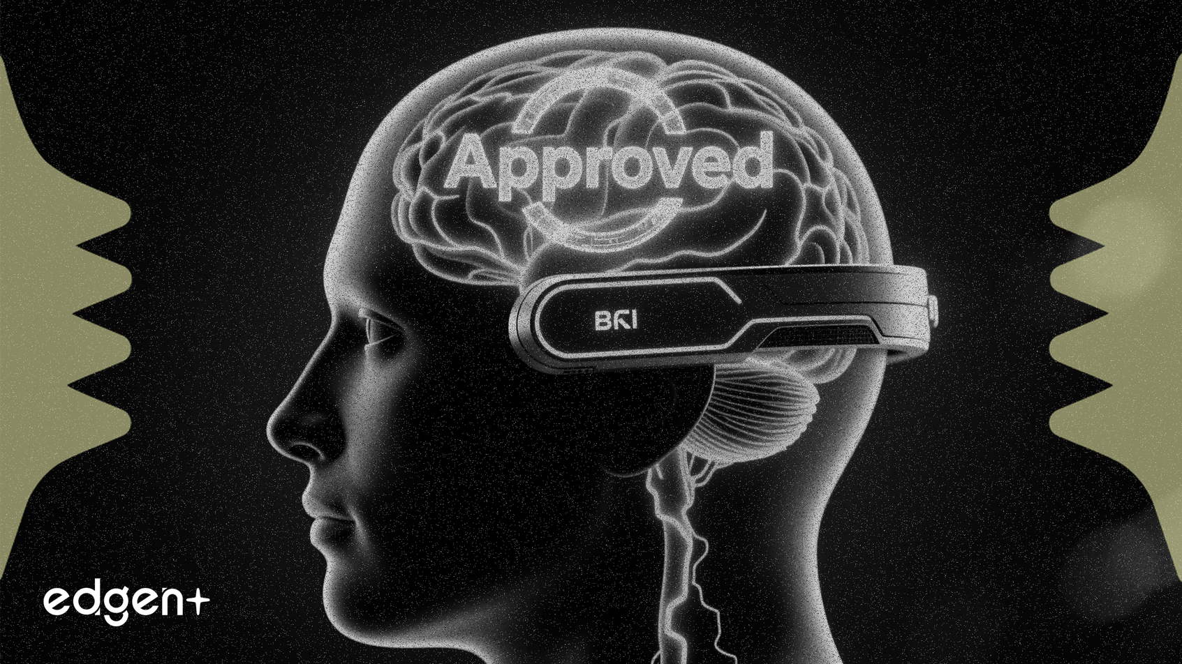 邁蘭德腦機介面設備獲批關鍵許可