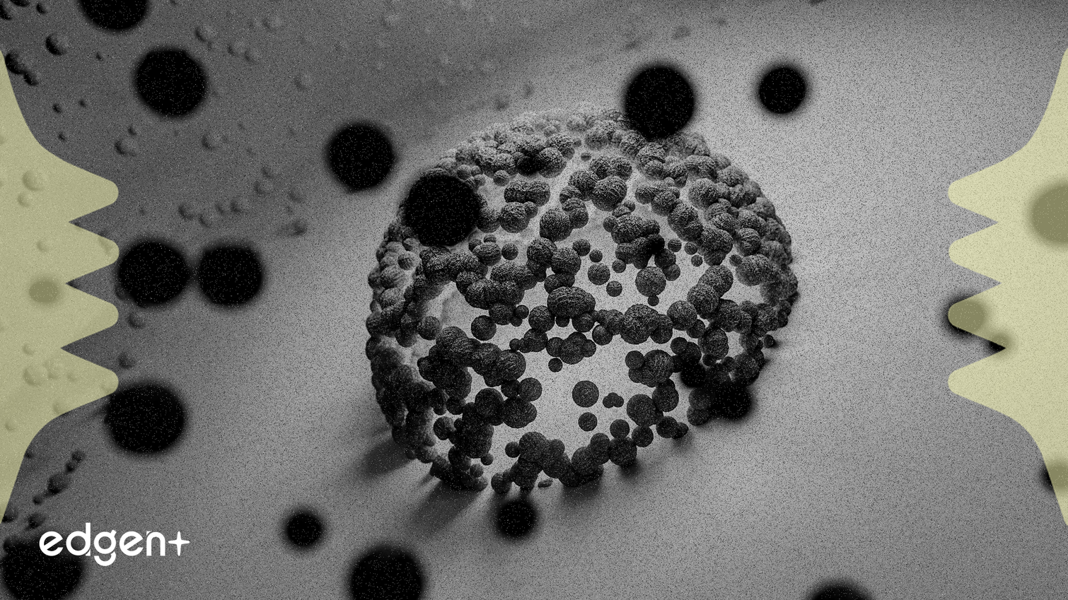 Ionis Pharmaceuticals Hisseleri, Alexander Hastalığı Deneme Verilerinin Olumlu Olmasıyla Yükseldi