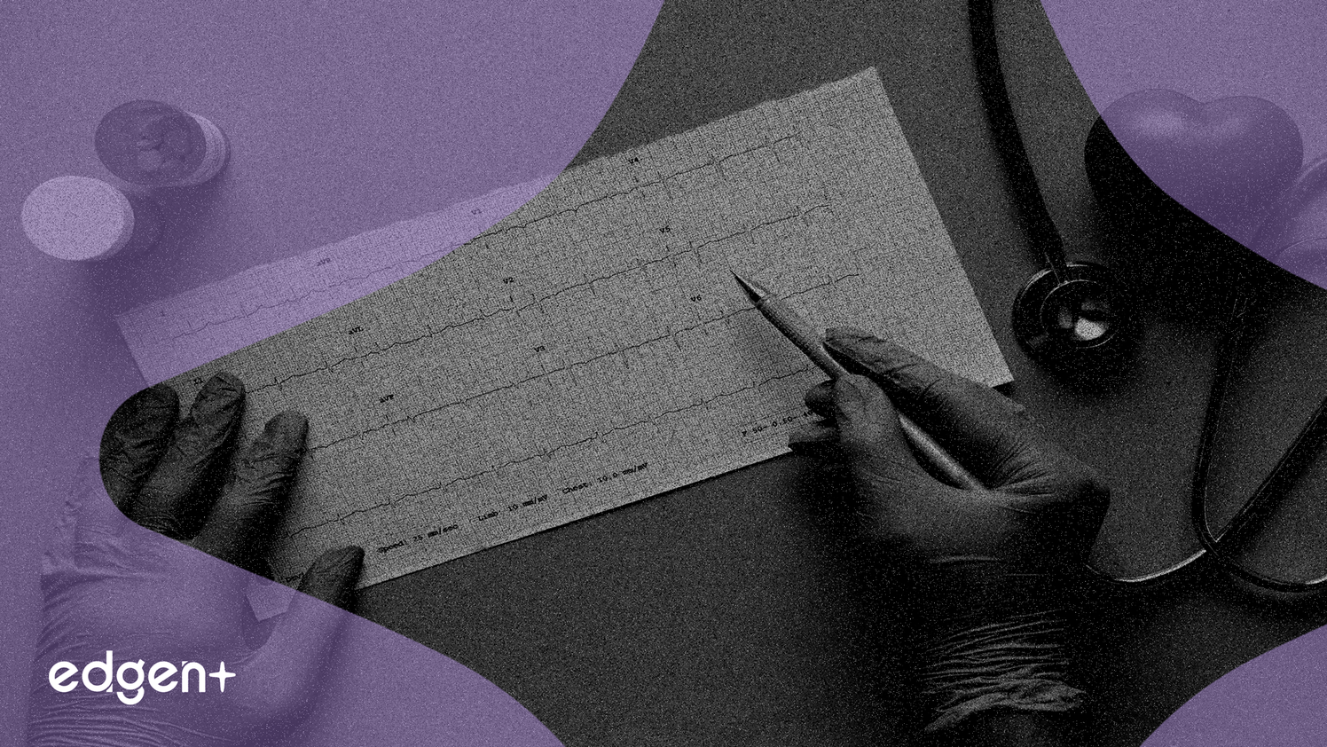 Hims & Hers Devance Tempus AI Grâce à une Valorisation Plus Attrayante