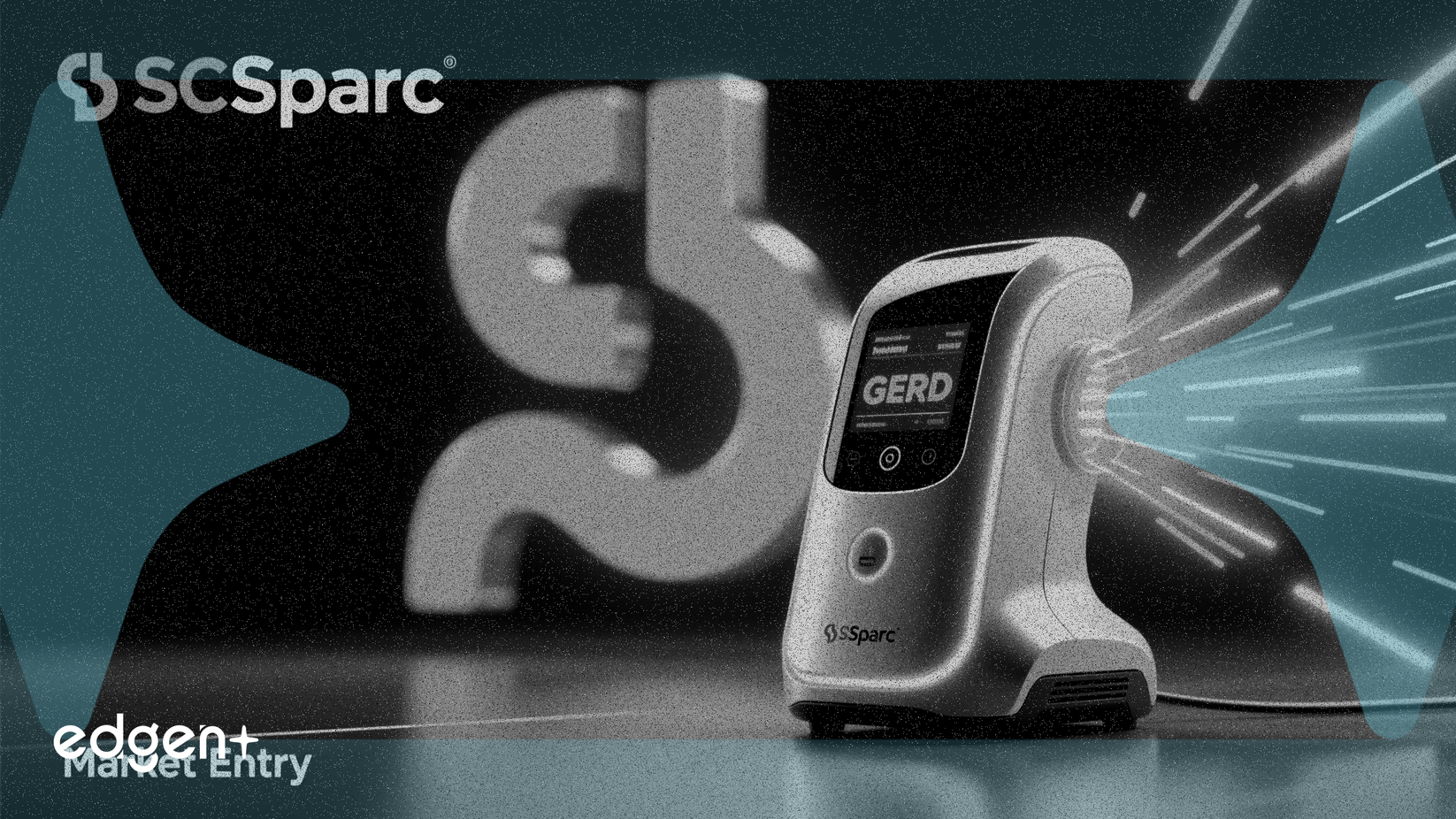 SciSparc, GERD Cihaz Pazarına Girmek İçin MUSE Sistemi Satın Alımını Tamamladı