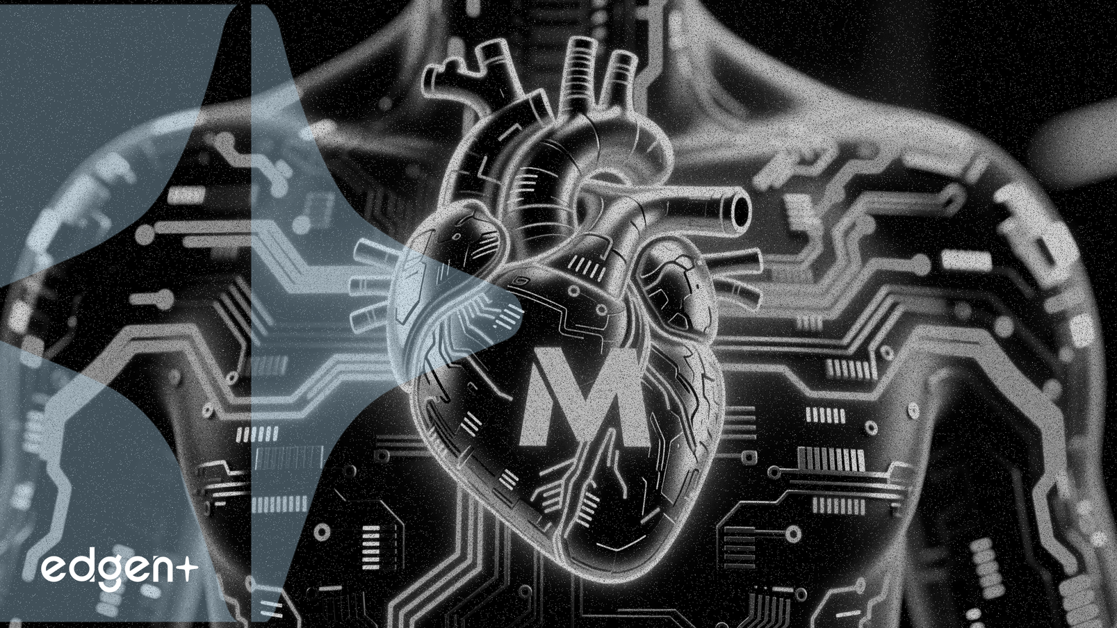 Medtronic va acquérir la société de technologie cardiaque IA CathWorks pour 585 millions de dollars