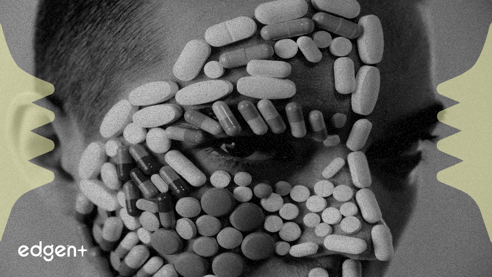 Viatris Shares Decline Following Blepharitis Treatment Trial Failure