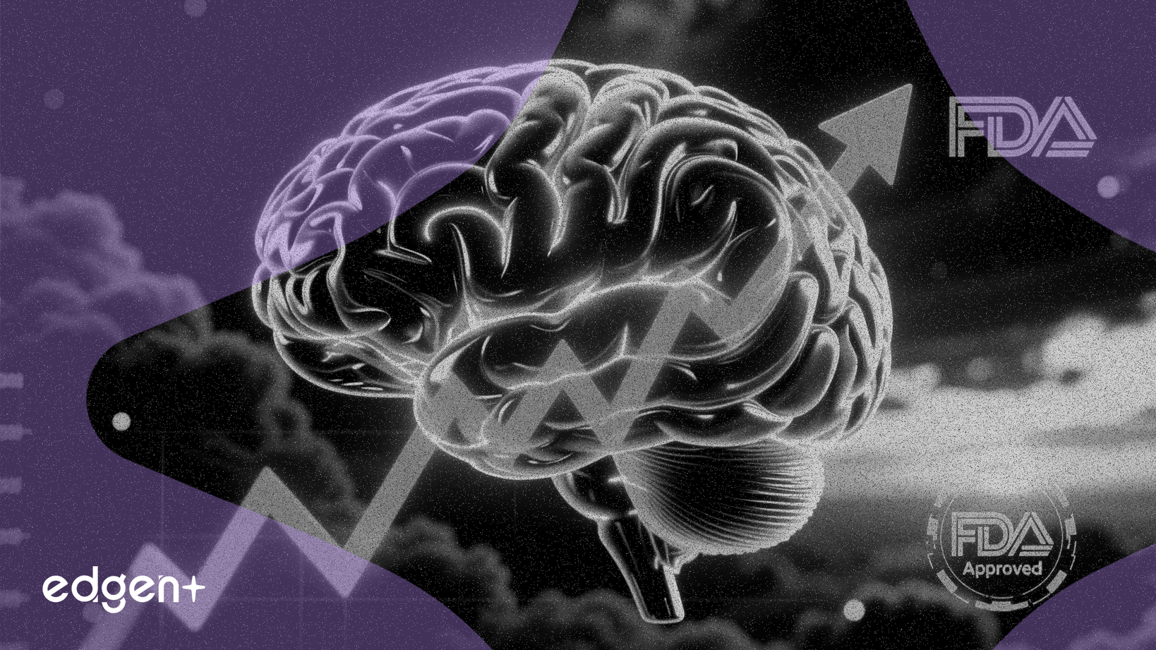 L'action BrainsWay grimpe suite à l'approbation par la FDA d'une thérapie réduisant de 70% le traitement de la dépression