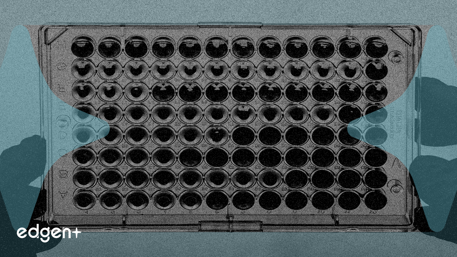 礼来数据显示Imlunestrant可减缓癌症进展