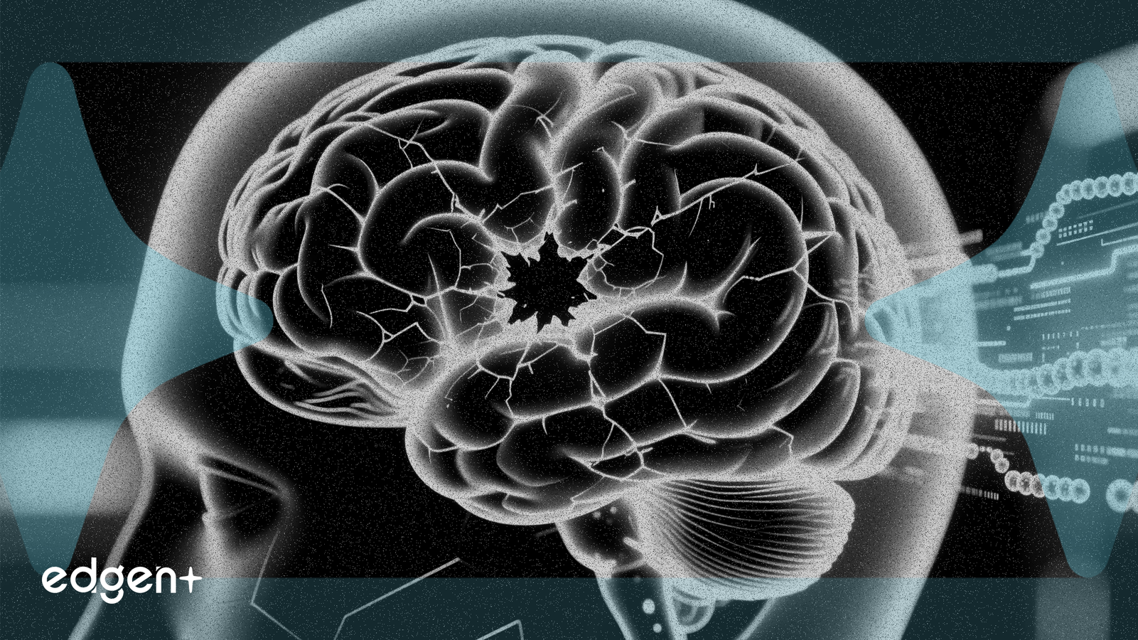 Immunic多发性硬化症药物试验显示脑部病变减少