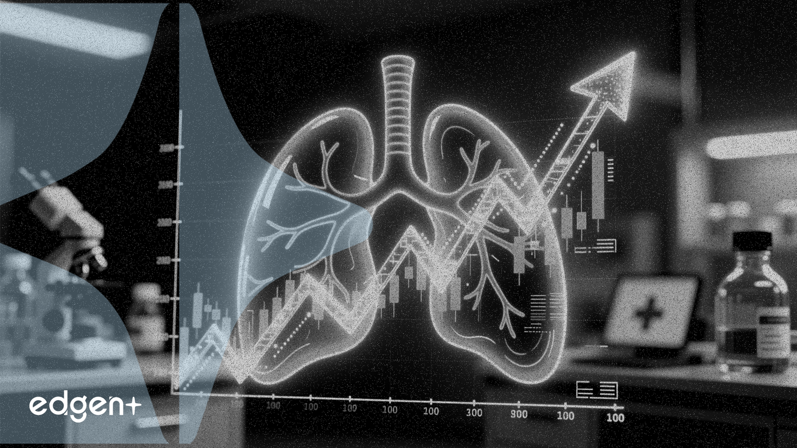 Las acciones de United Therapeutics se disparan un 32.8% por datos de fármaco pulmonar