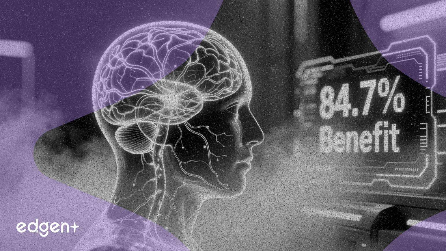 Anavexのアルツハイマー病薬、治験で84.7%の恩恵を示す