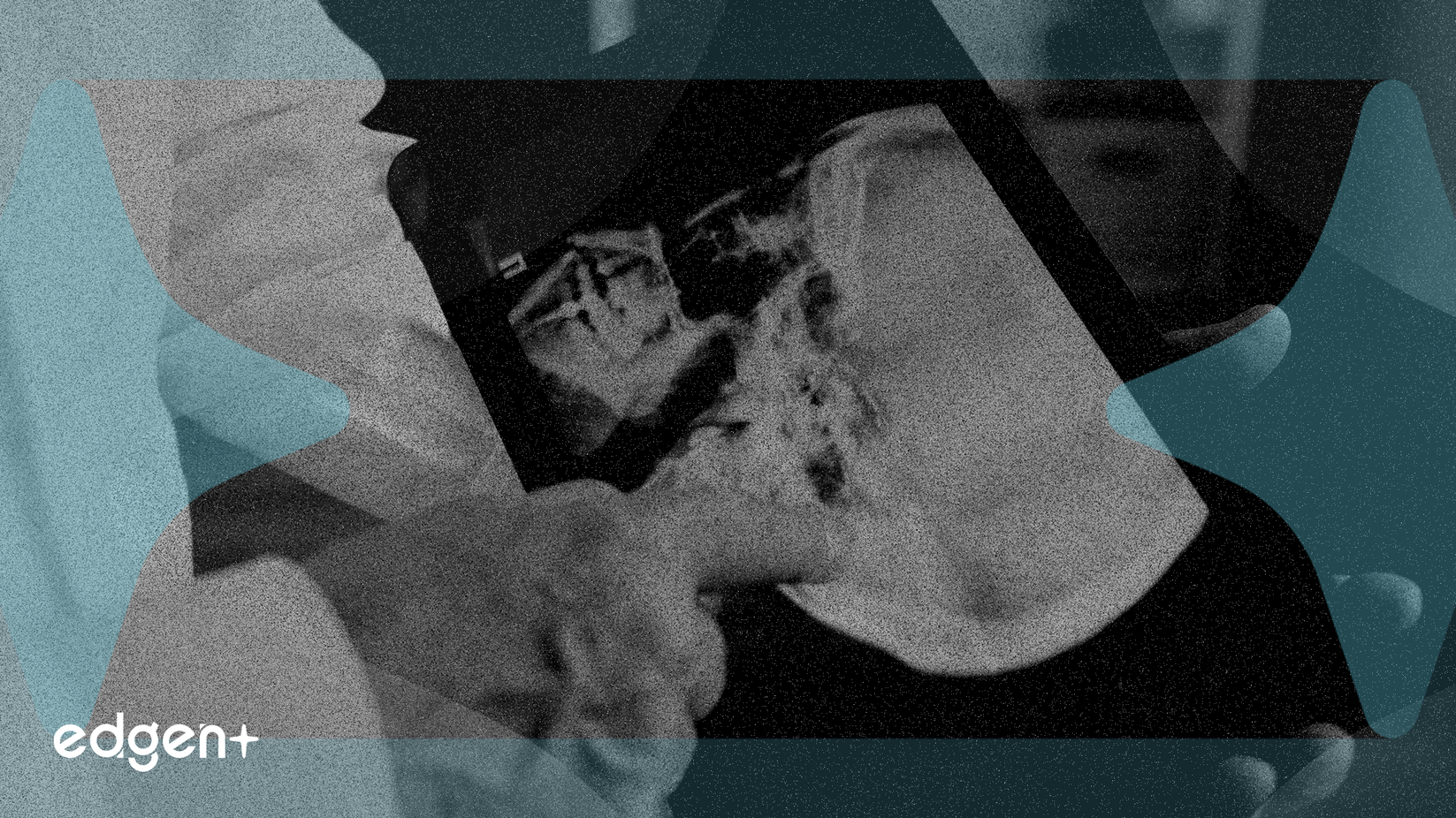 Butterfly Network Deploys AI to Boost Hospital Revenue