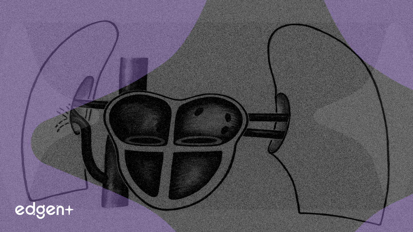 Abbott obtient l'approbation de la FDA et de l'UE pour son système de dispositif cardiaque pour nourrissons prématurés