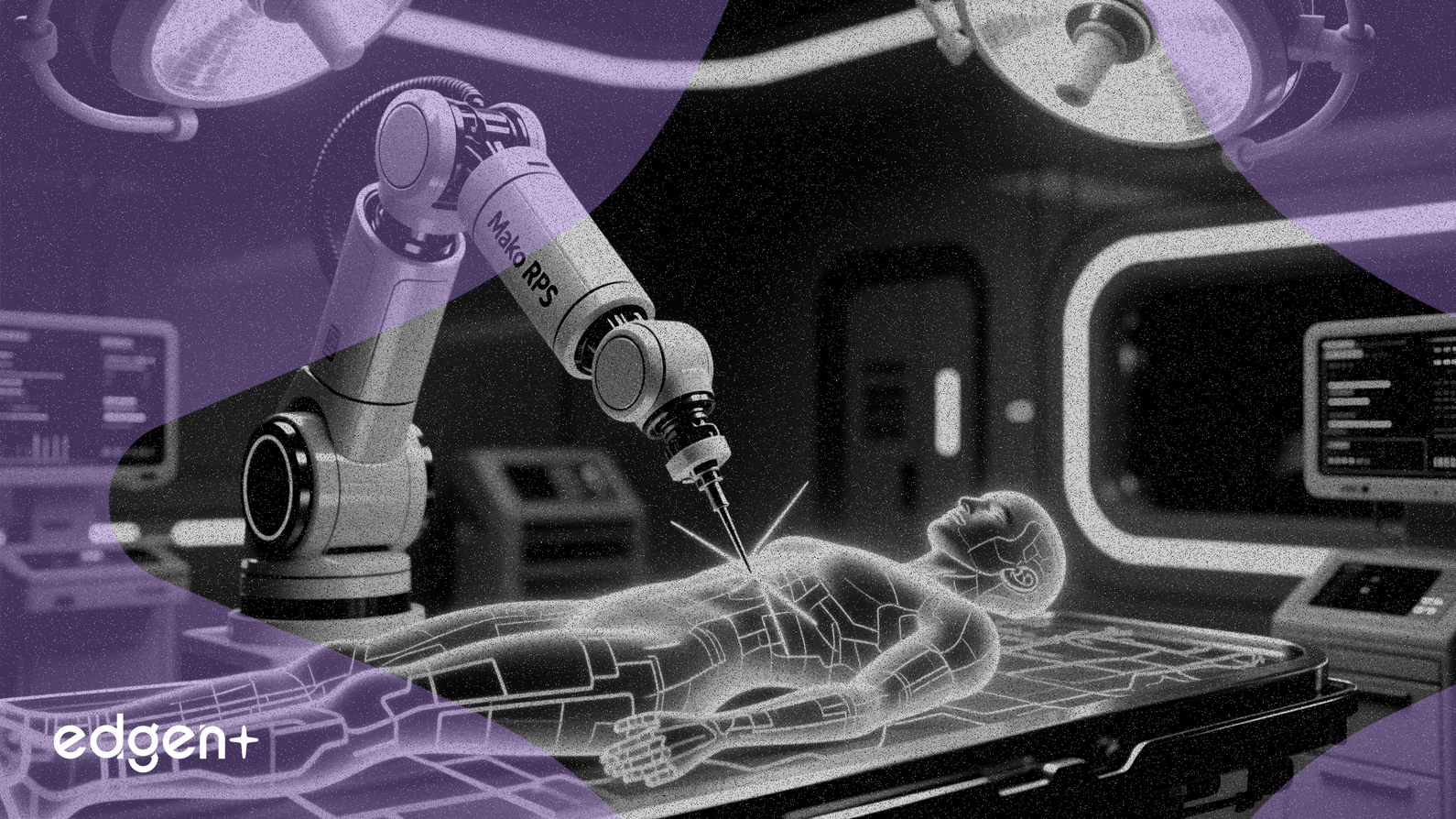 Stryker lance le Mako RPS pour étendre sa gamme de chirurgie robotique