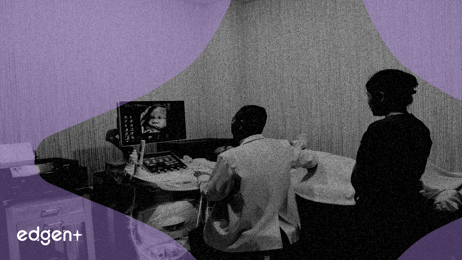 Vaso Corp Extends GE HealthCare Sales Deal Through 2030