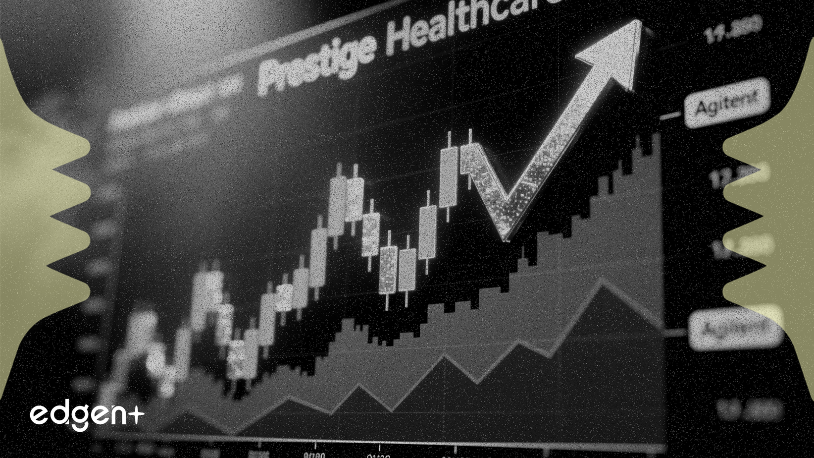 Prestige Healthcare se posiciona como una acción de valor superior a Agilent