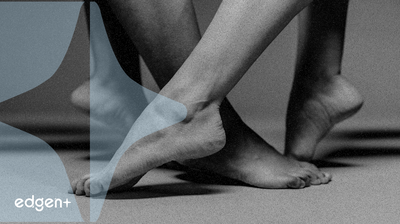 Notional V3 因 Balancer 漏洞停止运营,产生 721.6 ETH 坏账