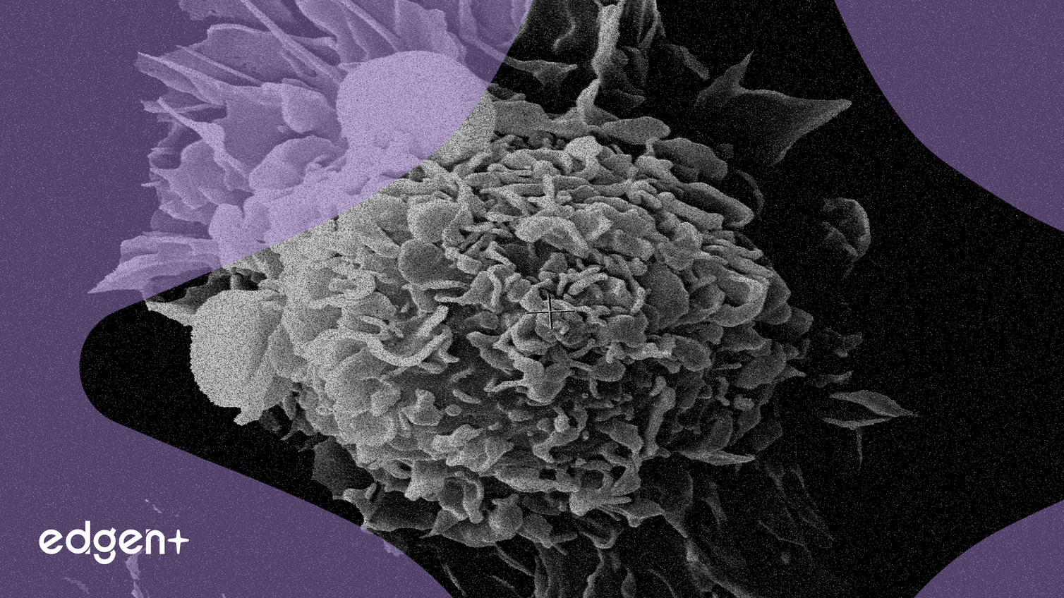 Faron Lance l'Essai BLAZE pour Combattre la Résistance à l'Immunothérapie