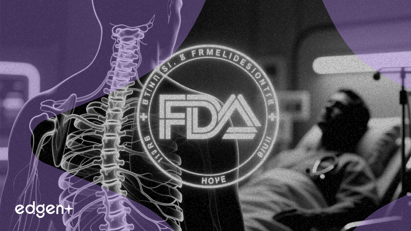 메소블라스트, 만성 요통 치료제 FDA 지지 확보