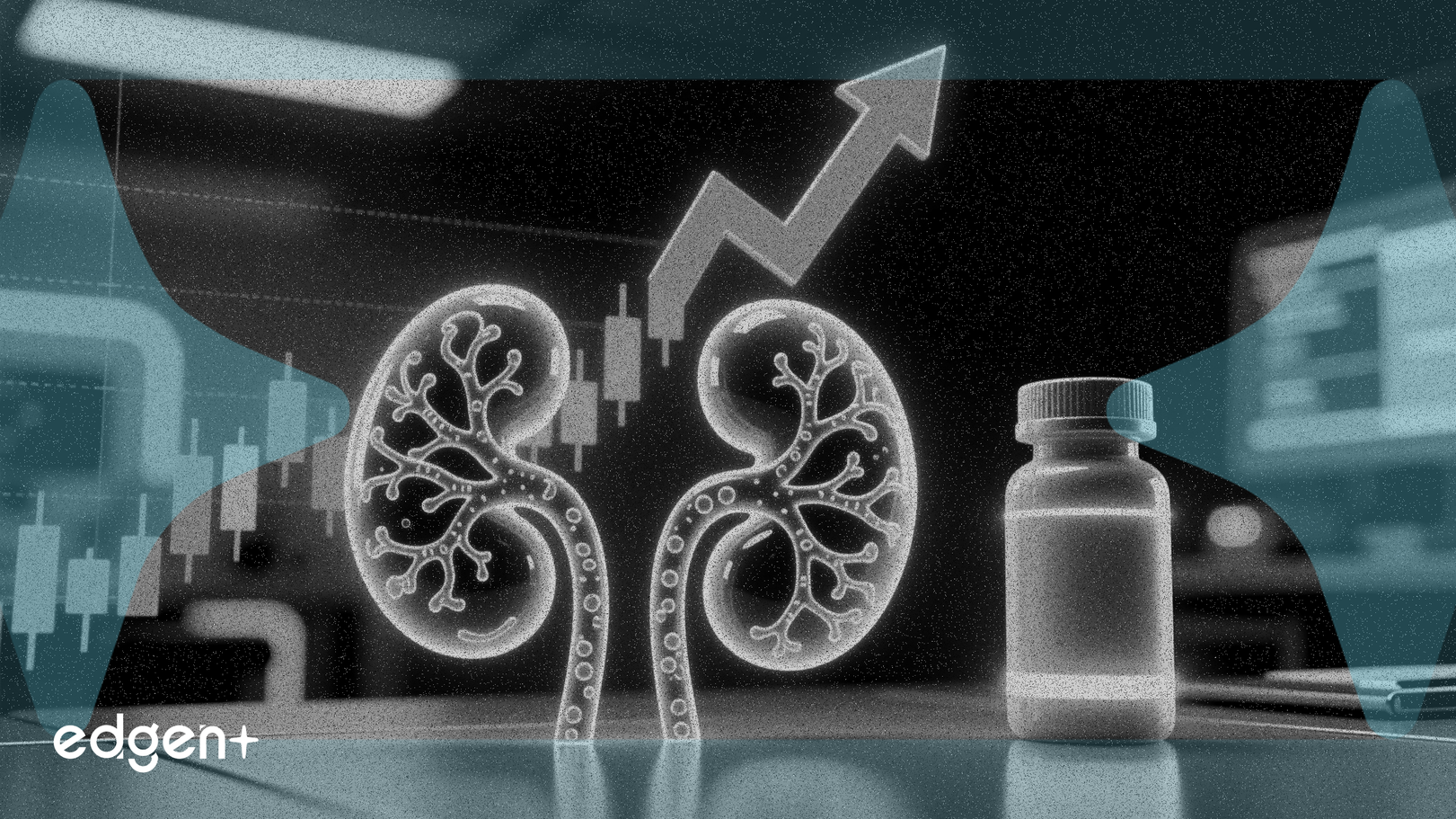 L'action Vertex progresse après le succès de l'essai de son médicament rénal