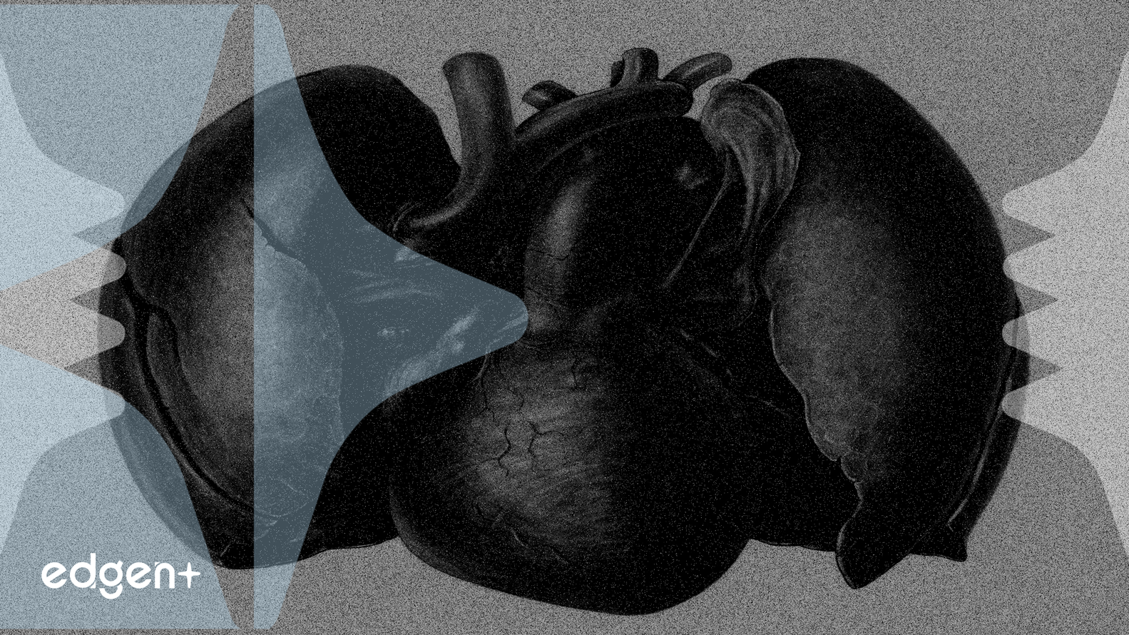 Edwards abre un nuevo mercado con la aprobación de la FDA para SAPIEN M3