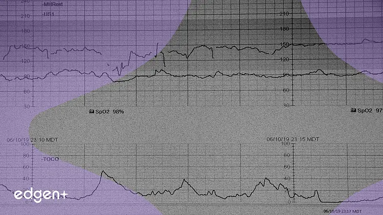 AstraZeneca's Baxdrostat Phase III Trial Demonstrates Significant Blood Pressure Reduction