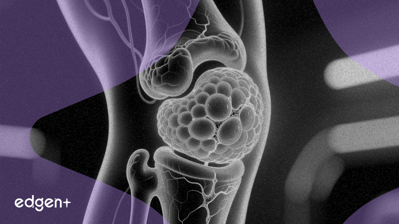 Regentis Báo Cáo Đột Phá Tái Tạo Sụn Trong Nghiên Cứu GelrinC Kéo Dài 2 Năm