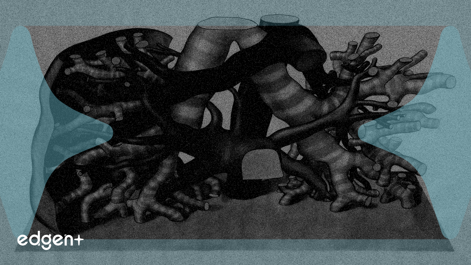 Denali, 헌터 증후군 치료제에 대한 2억 7,500만 달러 로열티 계약 확보