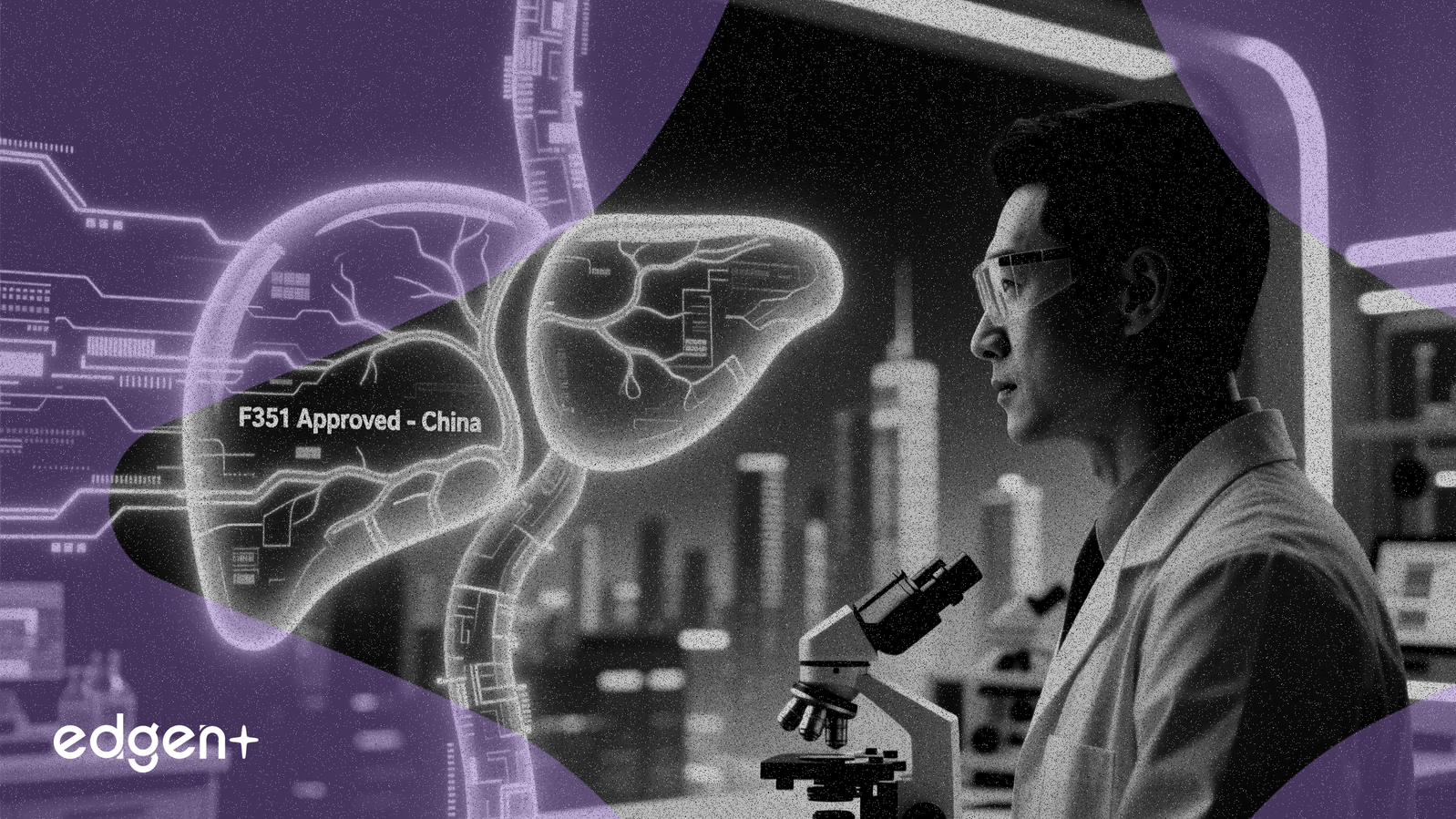 Gyreの肝臓病薬F351が中国で優先審査資格を獲得