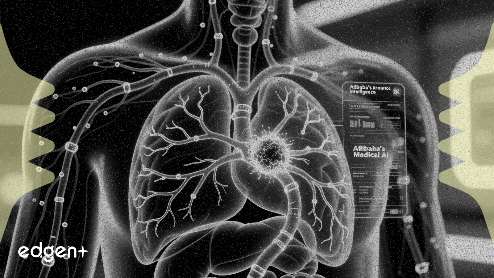 L'IA d'Alibaba Détecte des Cancers Précoces en Usage Clinique