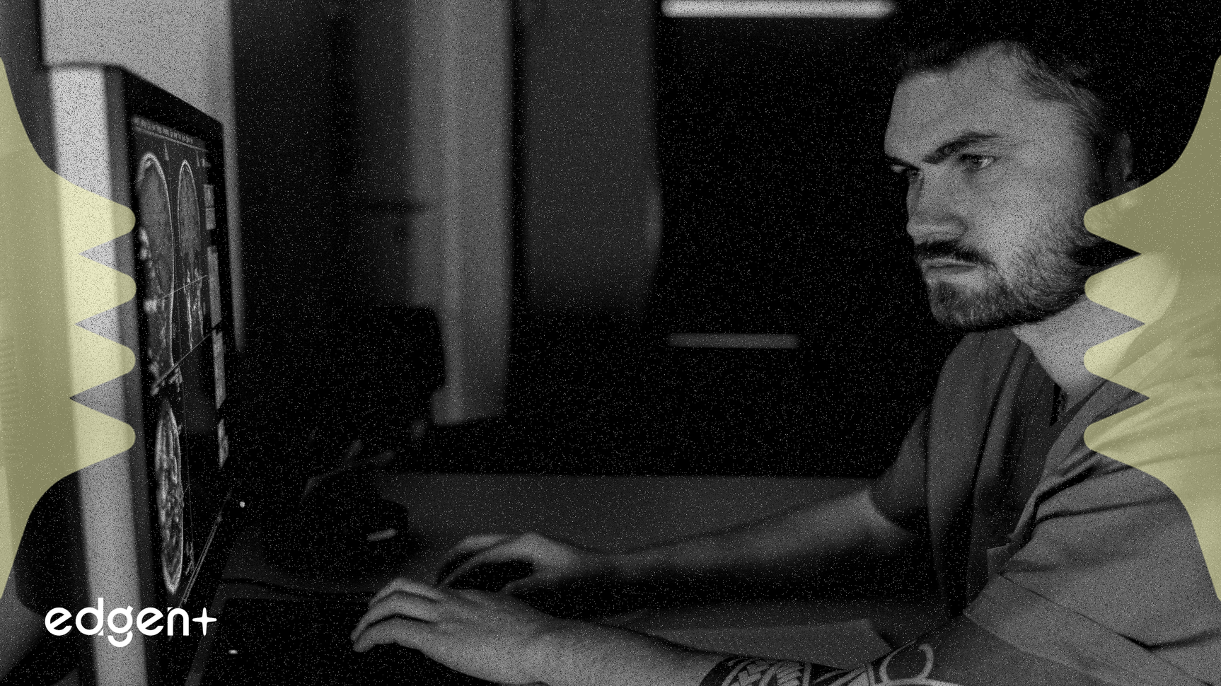 GE HealthCare Technologies chuẩn bị công bố thu nhập quý 3 trong bối cảnh lo ngại về tỷ suất lợi nhuận