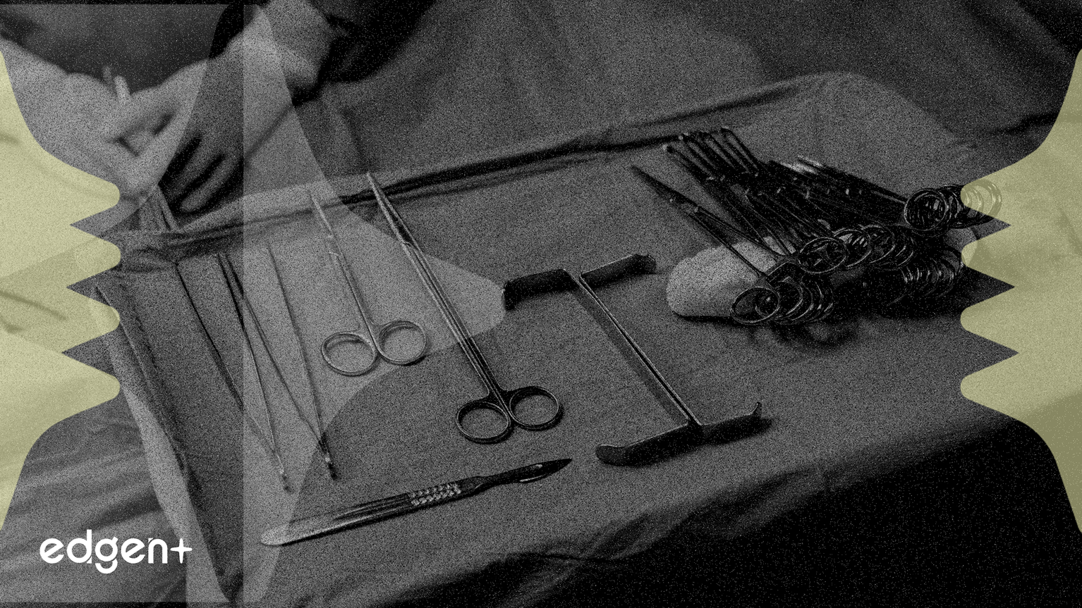 Intuitive Surgical affiche 20% de croissance, suscitant un débat sur sa durabilité