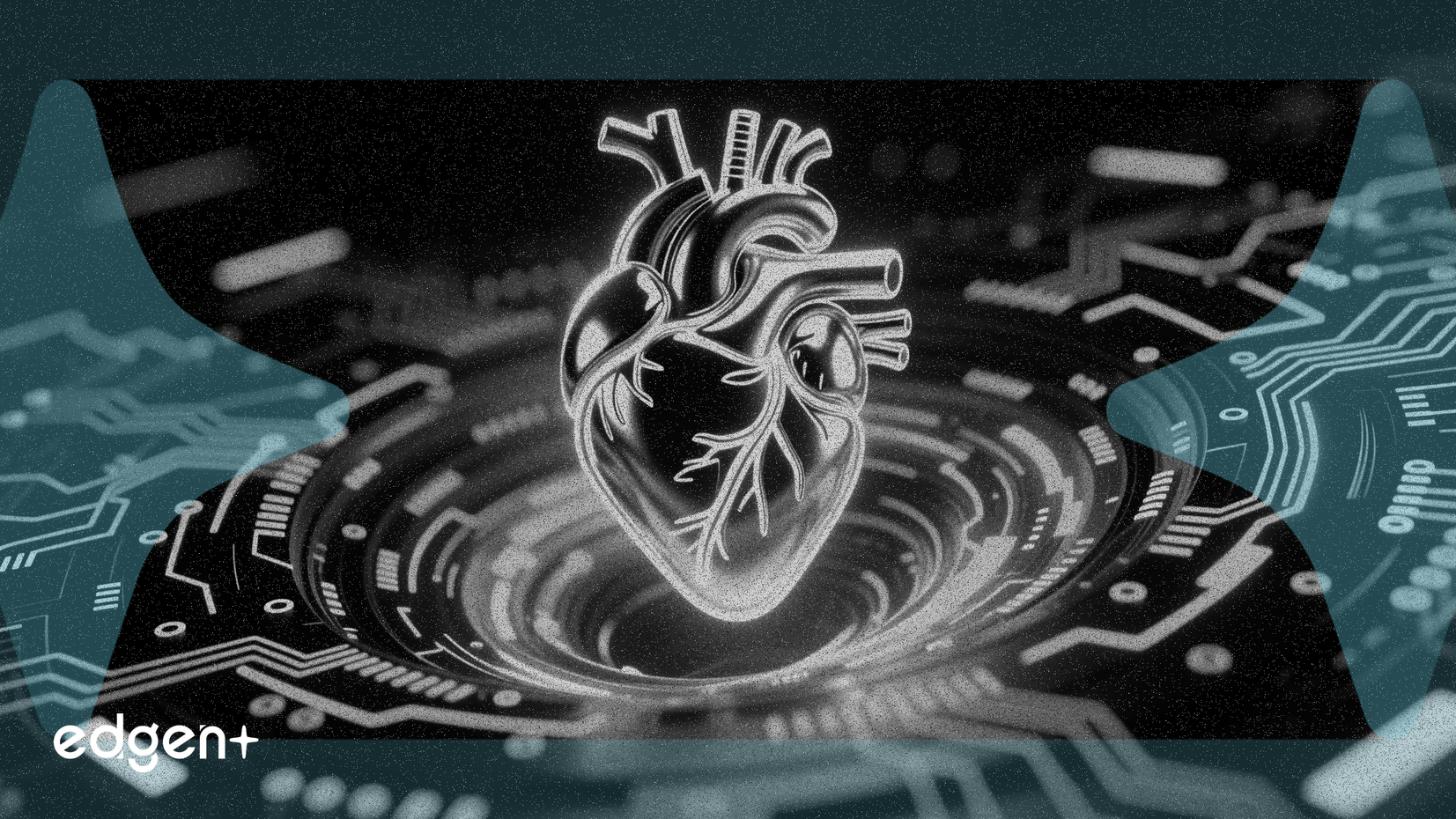 기술주 순환 속 에드워즈 라이프사이언스 상승