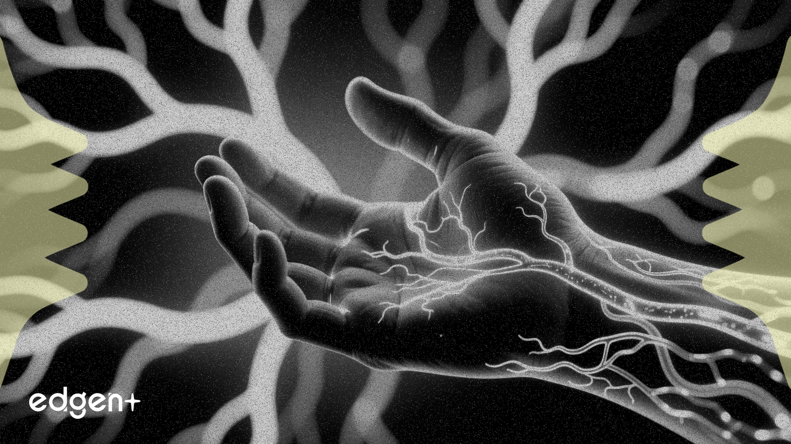 Anavex, Blarcamesine'in Parkinson Motor Bozukluğunu Tersine Çevirdiğini Bildirdi