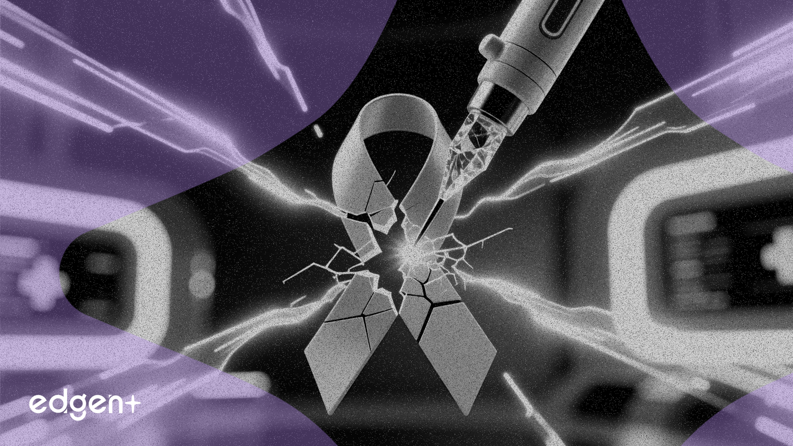 유방암 신규 가이드라인, IceCure의 냉동절제술 기술을 촉진할 것