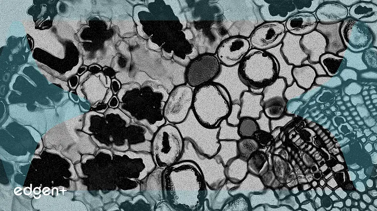 ClearPoint Neuro 任命首席醫療官,股價上漲