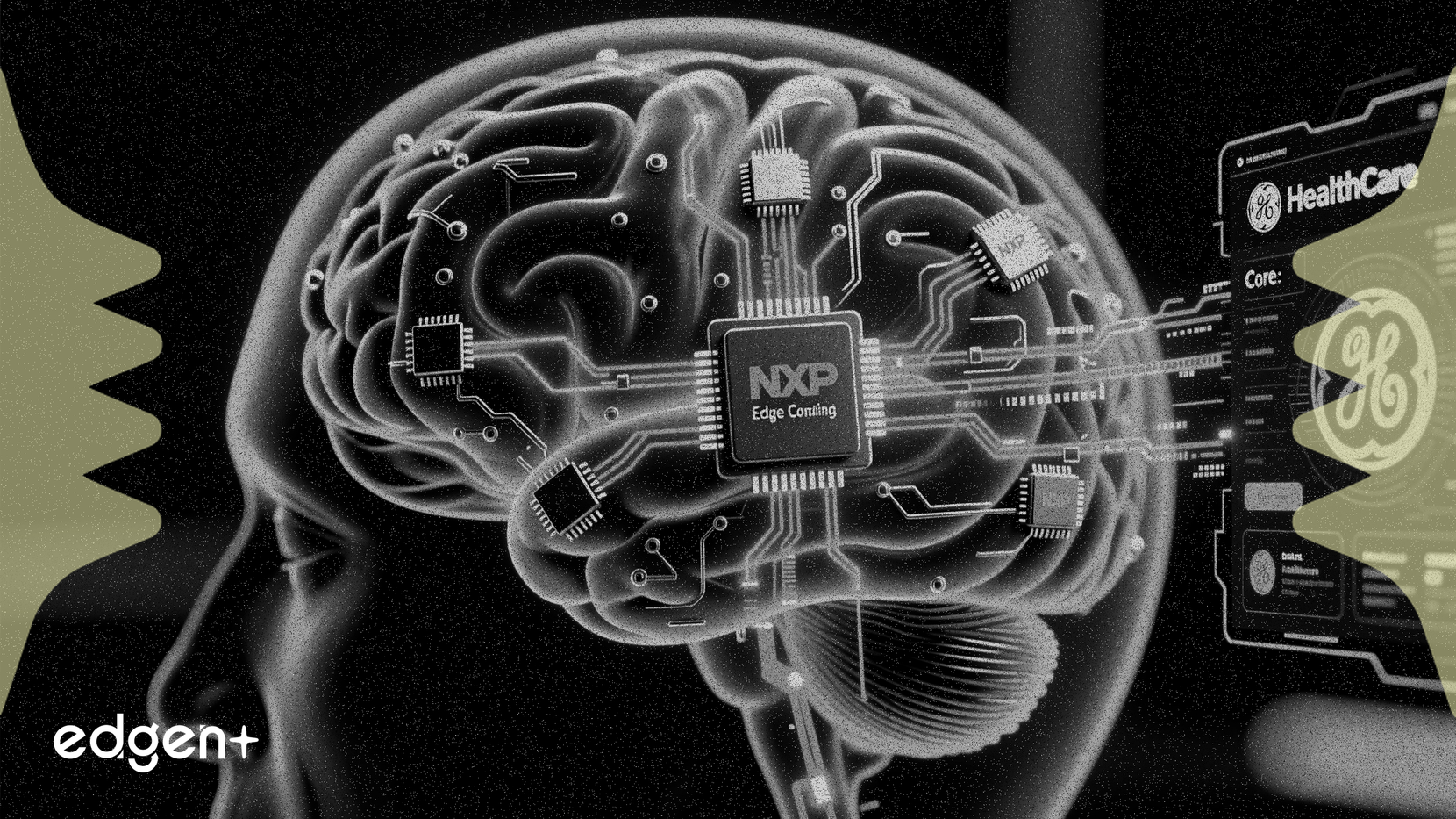 GEヘルスケア、NXPとのエッジコンピューティング契約でAI推進を強化