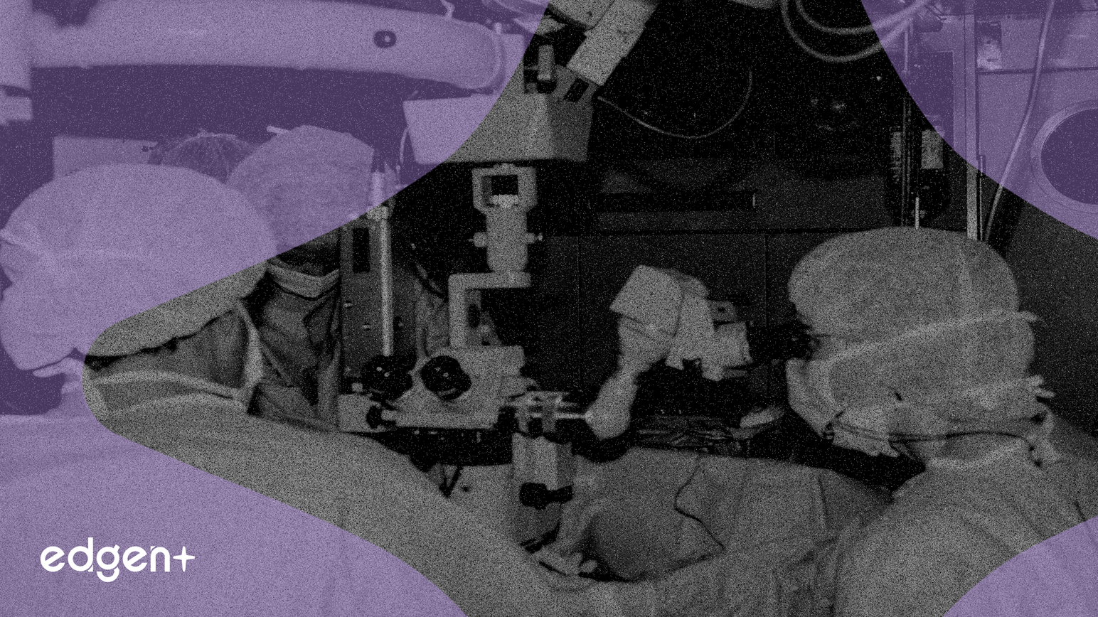 韓國市場推動下，直覺外科單孔（SP）手術量增長91%