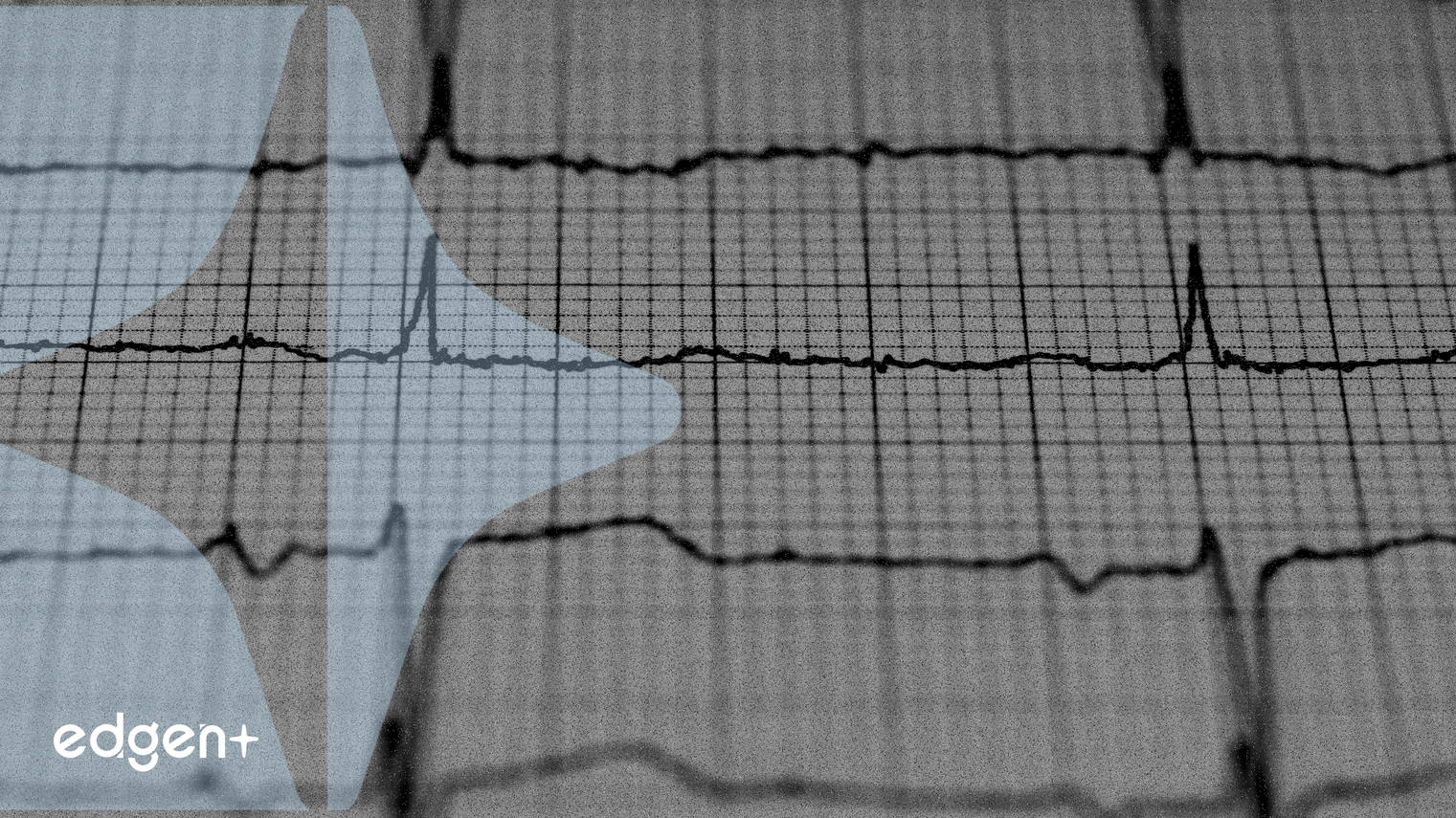 USDT主導地位逼近通道頂部,預示山寨幣資金輪動潛力