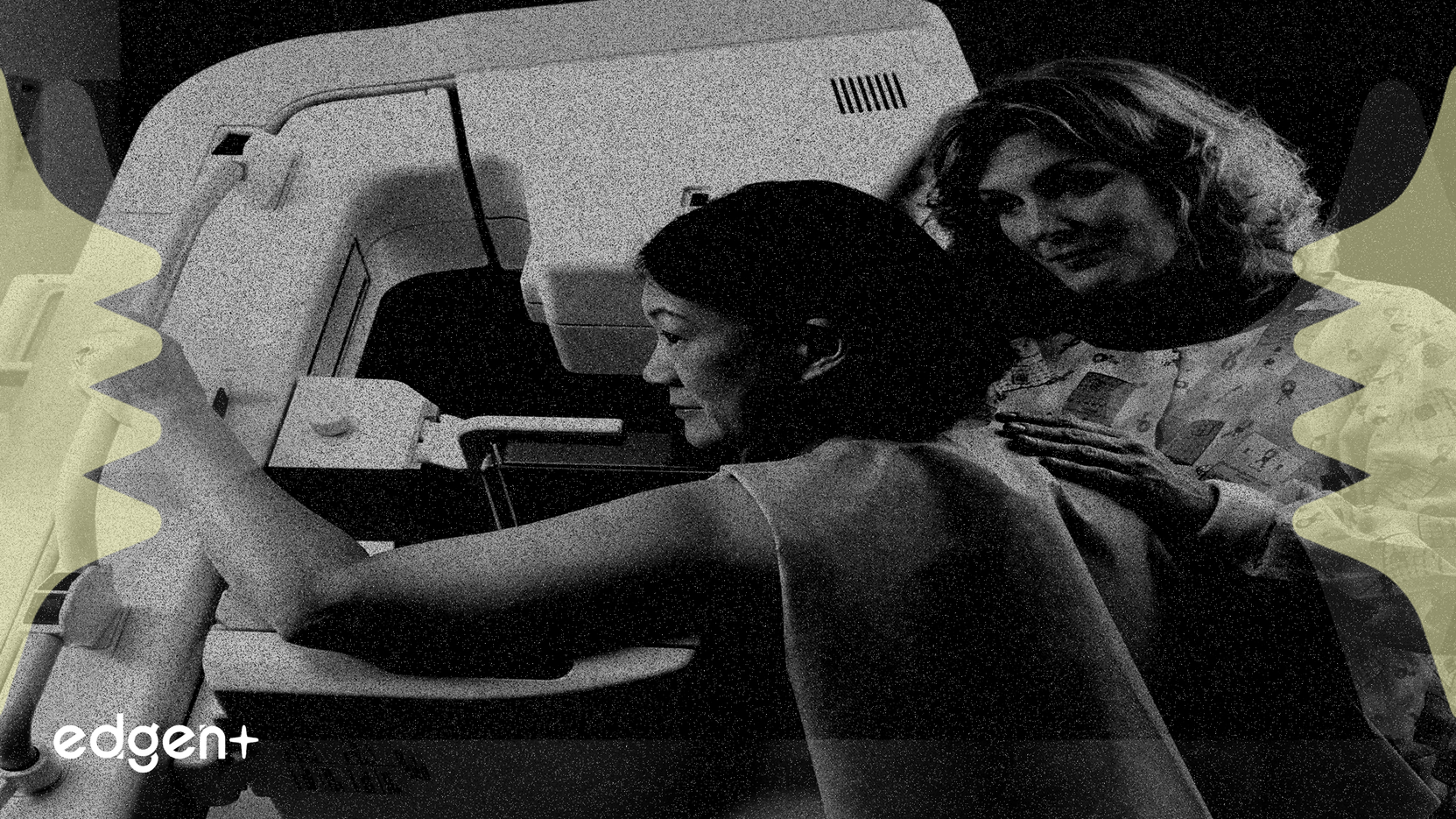 Elekta ra mắt hệ thống Evo được hỗ trợ bởi AI, củng cố vị thế trên thị trường xạ trị thích ứng