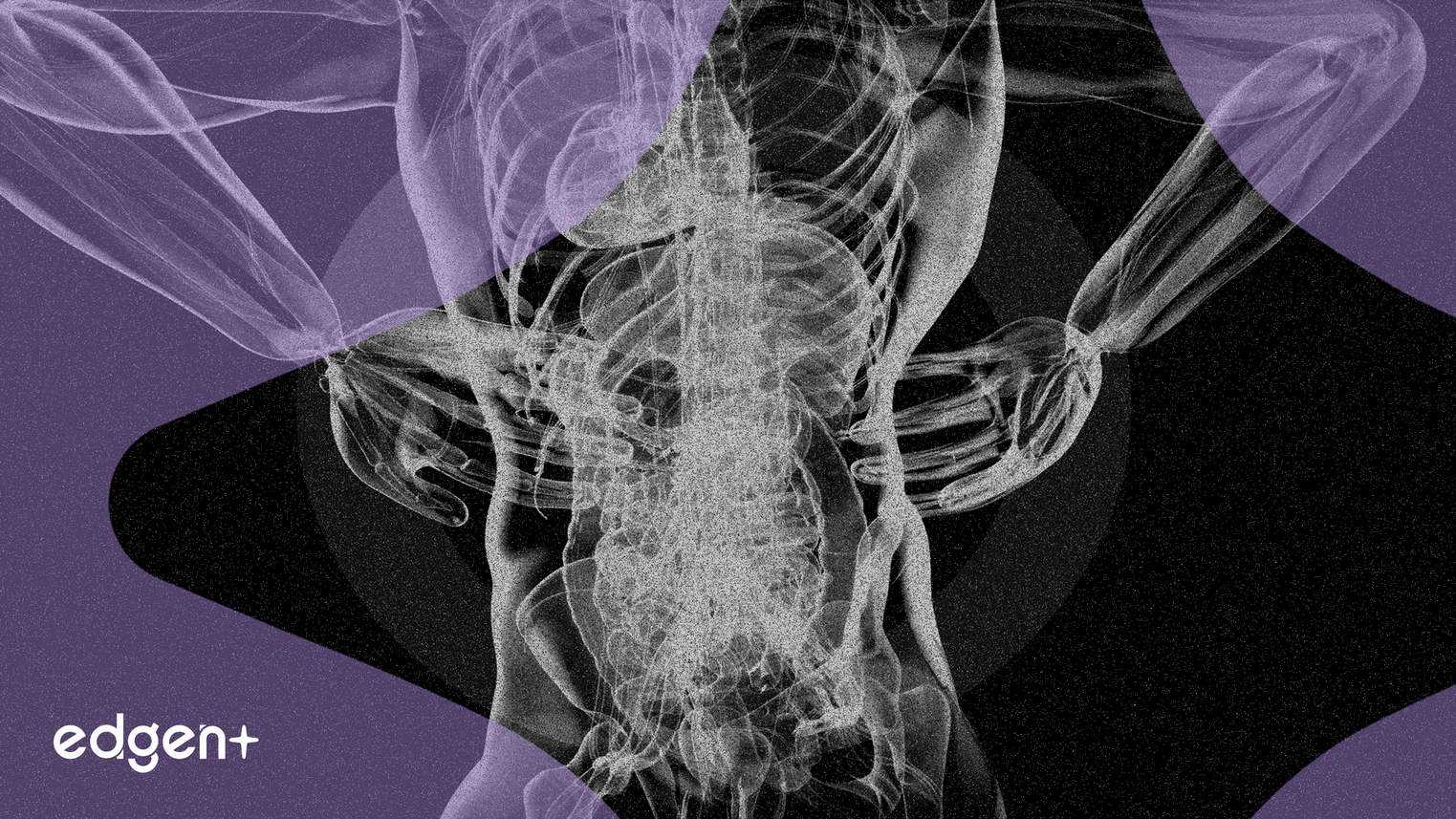 Pacira's Iovera Cuts Back Pain Scores by Over 50% vs RFA in Study