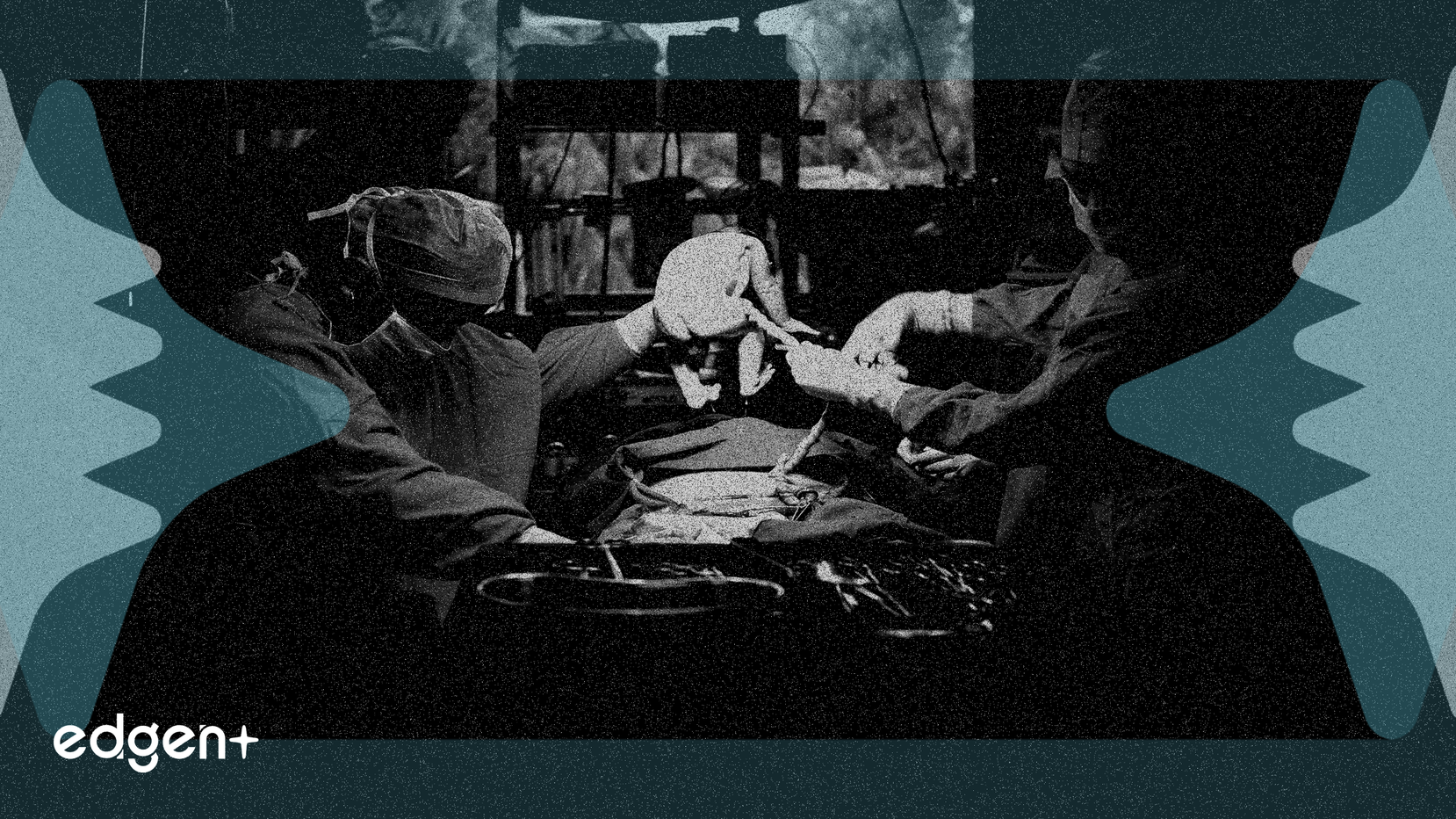 Intuitive Surgical gagne 7,5%, son orientation robotique surpassant le portefeuille diversifié de Stryker