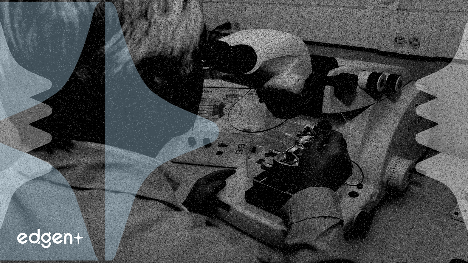 몬테 로사, 항암제 성공에 힘입어 4년 최고치 경신