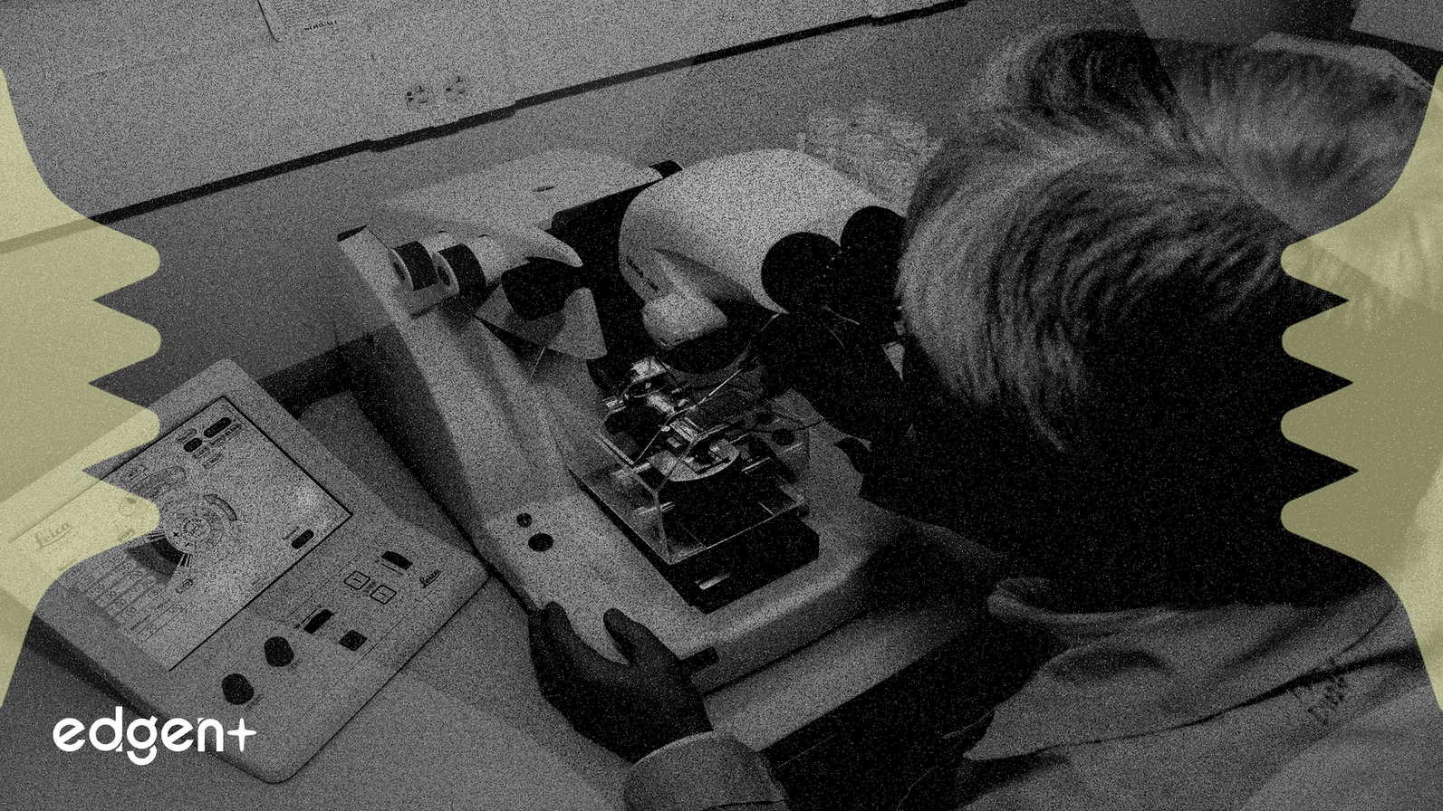 Pfizer/Astellas Kanser Tedavisi Mesane Kanseri Sağkalımını İyileştiriyor