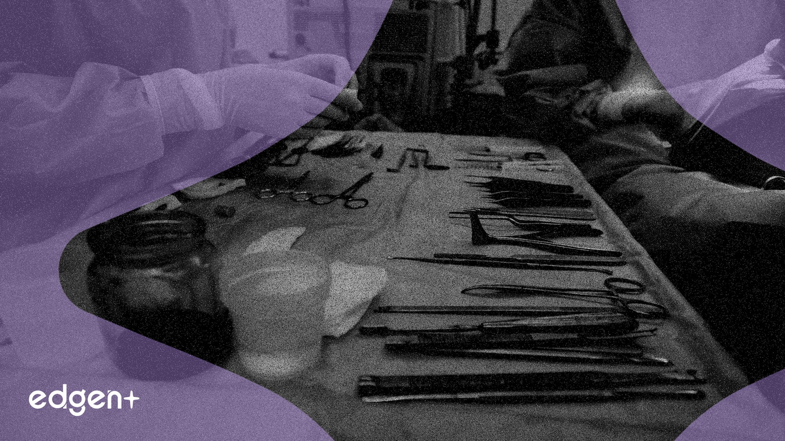 Intuitive Surgical、欧州直販で高マージンを狙う