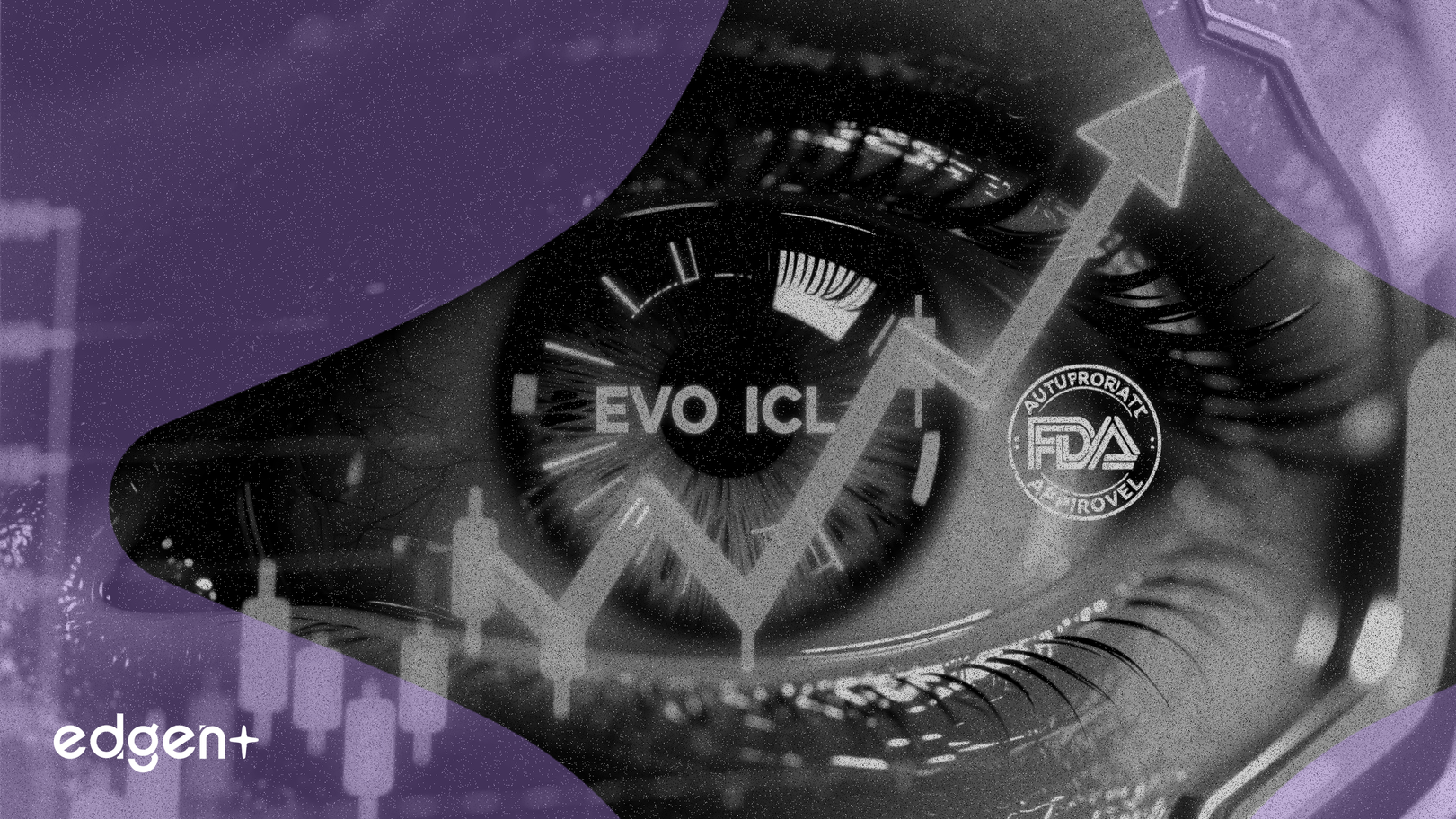 STAAR Surgical Gains 8% on Expanded FDA Approval for EVO ICL