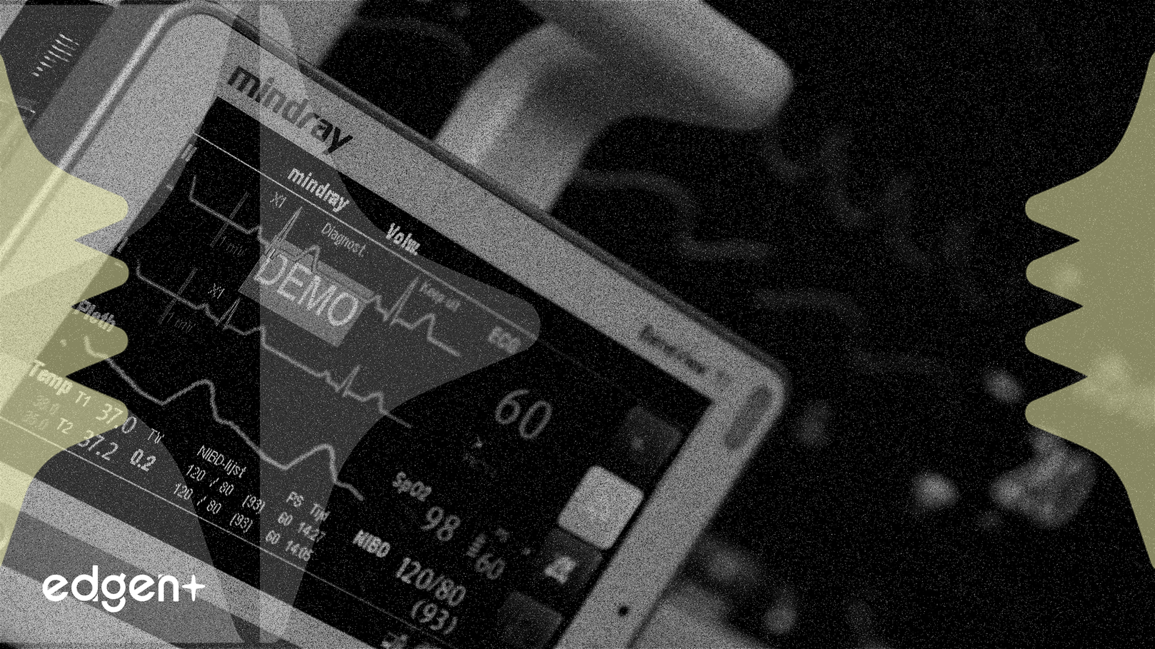 HeartBeam 获 FDA 批准，股价飙升