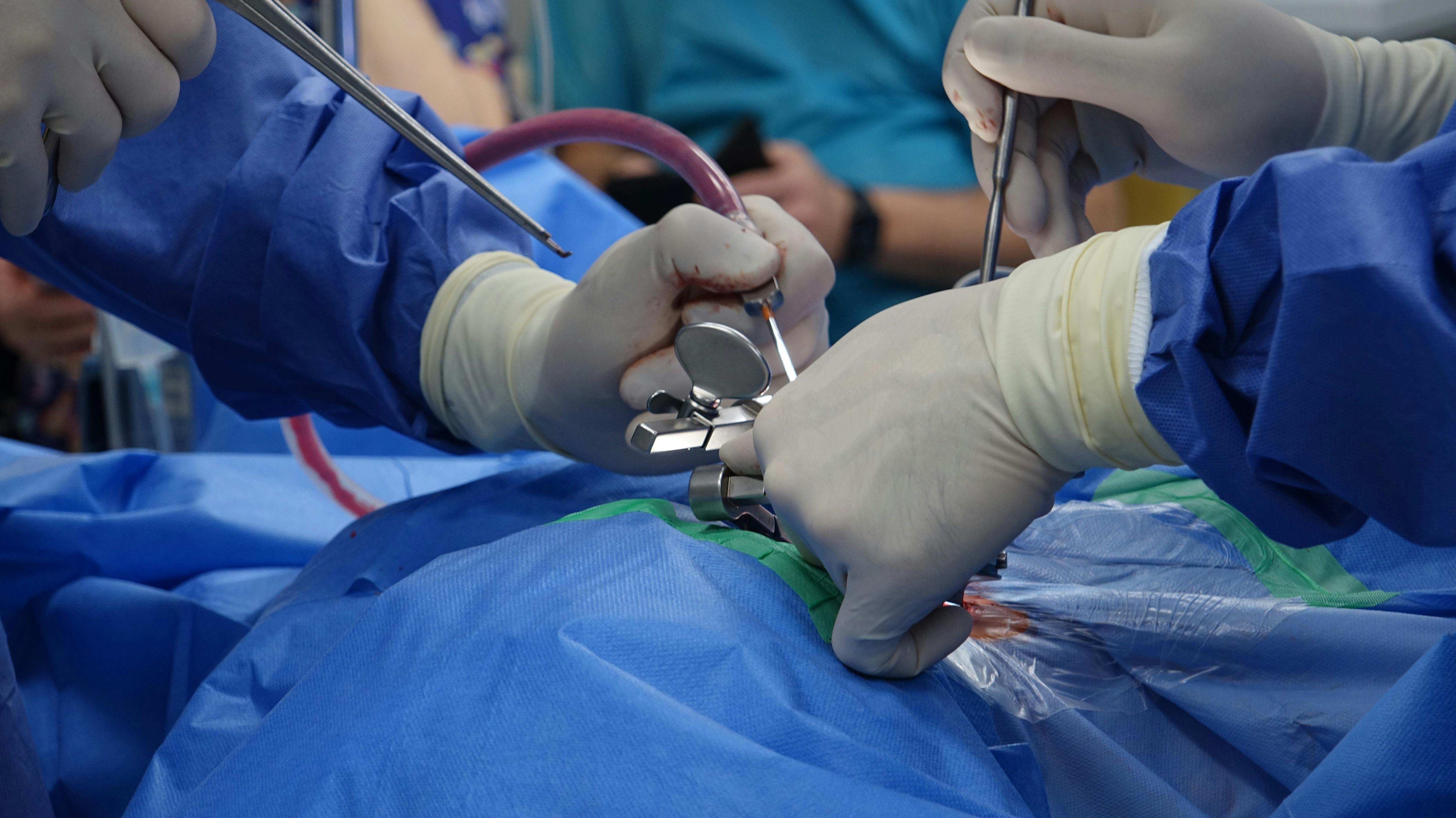 Intuitive Surgical Hisseleri Uluslararası Rüzgarlar ve Gümrük Endişeleri Arasında Geriliyor