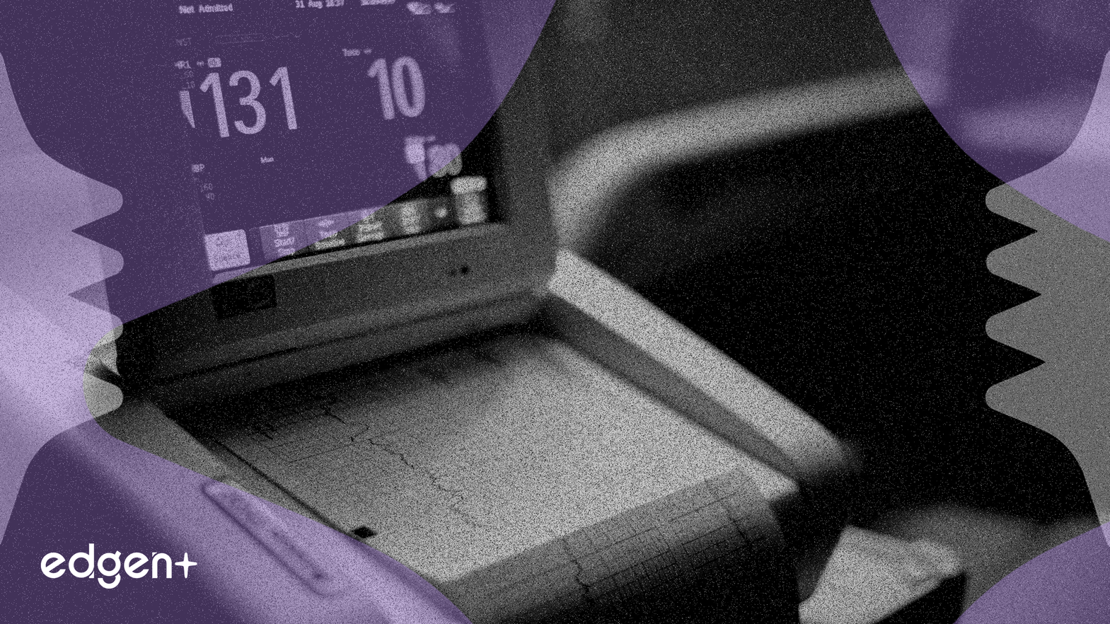 GE HealthCare Teknoloji Gelişmeleri, Analist Fiyat Hedefi Revizyonlarında Karışık Sonuçlar Doğurdu